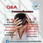 เรื่อง “Q&A โรคหลอดเลือดสมอง”